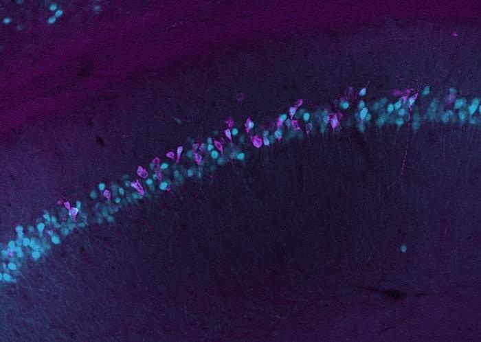 Imagen: Reportero RMA (magenta) expresado en respuesta al marcador de actividad neuronal (cian) en el hipocampo (Imagen cortesía de Sho Watanabe/Rice University)