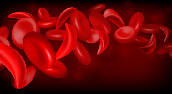 Imagen: La detección precisa de la diabetes es esencial para la atención oportuna, pero el rendimiento de la prueba puede variar en personas con variantes de hemoglobina, como el rasgo de células falciformes (Crédito de la imagen: Shutterstock)