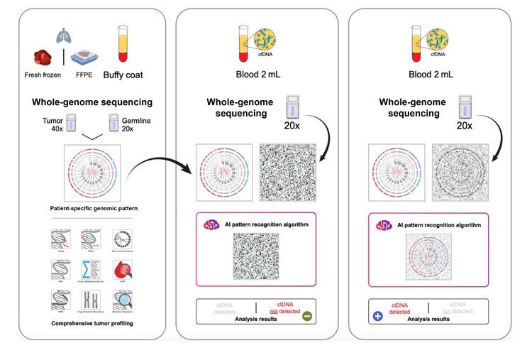 Imagen: El ADN del tumor se extrae de una muestra patológica y el ADN normal se extrae de la capa leucocitaria. Ambas muestras se someten a WGS para generar la firma mutacional específica del paciente. En cada seguimiento, el ADNtc extraído del plasma se somete a WGS y se analiza utilizando una firma derivada del paciente y un algoritmo de reconocimiento de patrones de inteligencia artificial (IA). FFPE: fijado con formalina, incluido en parafina. (Snuderl M, Smadbeck J, Wilkins R, et al. The Journal of Molecular Diagnostics, 2026. DOI: 10.1016/j.jmoldx.2026.07.003)