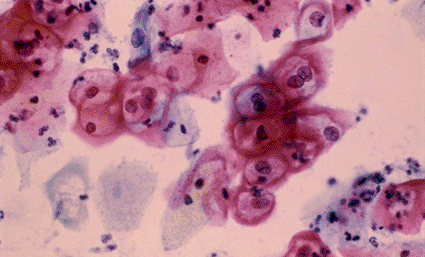 virus del papiloma microbiologia