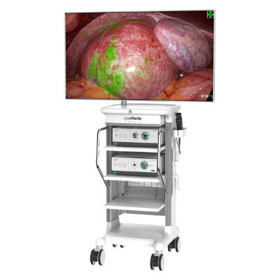 FLUORESCENCE ENDOSCOPIC SYSTEM