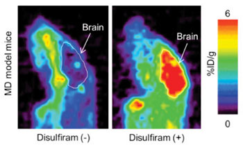 Imagen A: Imagen obtenida por TEP de un corte sagital del cerebro, cuatro horas después de una inyección de Cu64Cl2 con disulfiram o D-penicilamina en un modelo de ratones con EM (Fotografía cortesía del Centro RIKEN de Tecnologías para Ciencias Biológicas).