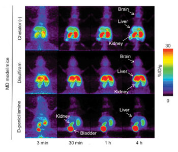 Imagen B: Imagen obtenida por TEP de un corte coronal de cuerpo entero, cuatro horas después de una inyección de Cu64Cl2 con disulfiram o D-penicilamina en un modelo de ratones con EM (Fotografía cortesía del Centro RIKEN de Tecnologías para Ciencias Biológicas).