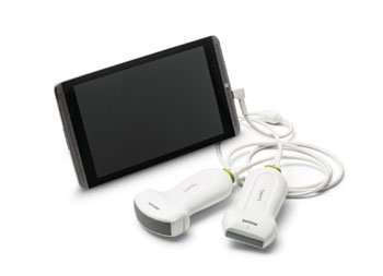 Ecógrafo portátil se conecta a teléfono inteligente - Ultrasonido -  mobile.