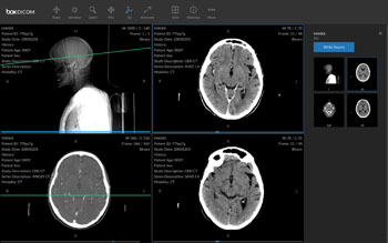 Imagen: El visor DICOM para rayos X, tomografía computarizada o resonancia magnética, ultrasonidos y mamografías (Fotografía cortesía de Box).