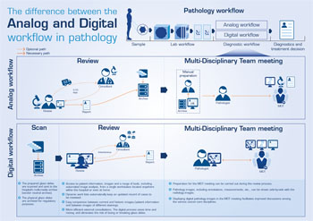 Imagen: Un gráfico que muestra la diferencia entre los flujos de trabajo digital y análogo en Patología (Fotografía cortesía de Sectra).