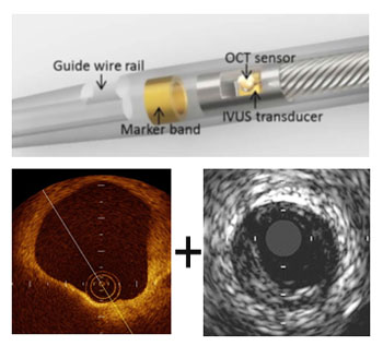 Imagen: El dispositivo IVUS-OCT puede capturar imágenes de infrarrojo y de ultrasonido y ayudar a encontrar la placa que podría causar un ataque al corazón o un derrame cerebral (Fotografía cortesía del Instituto Nacional de Imágenes Biomédicas y Bioingeniería de Estados Unidos).