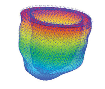 Imagen: Un modelo a escala múltiple del corazón humano, hecho mediante resonancia magnética (Fotografía cortesía de la Universidad de Glasgow).