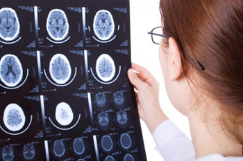 Imagen: La nueva asociación pretende desarrollar una herramienta de apoyo para mejorar los resultados para los pacientes con accidentes cerebrovasculares (Fotografía cortesía de Bigstock). Imagen: La nueva asociación pretende desarrollar una herramienta de apoyo para mejorar los resultados para los pacientes con accidentes cerebrovasculares (Fotografía cortesía de Bigstock).