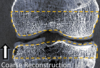 Imagen: La reconstrucción con imágenes de una articulación utilizando CBCT/CMOS (Fotografía cortesía de la Universidad Johns Hopkins).