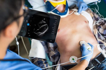 Imagen: El transductor cardíaco, S4-1 POC y el sistema Lumify (Fotografía cortesía de Philips Healthcare).