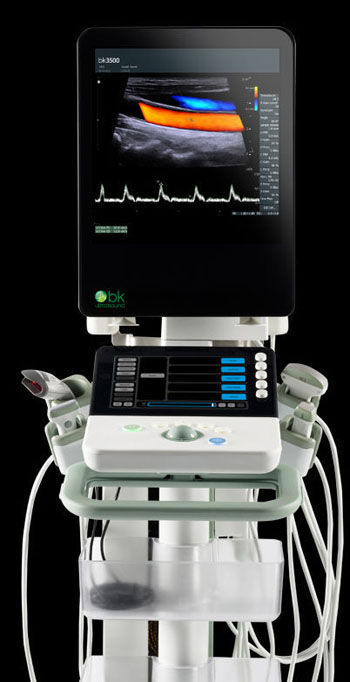 Imagen: El nuevo sistema de ultrasonido bk3500, diseñado para uso en los servicios de urgencias (Fotografía cortesía de Analogic).