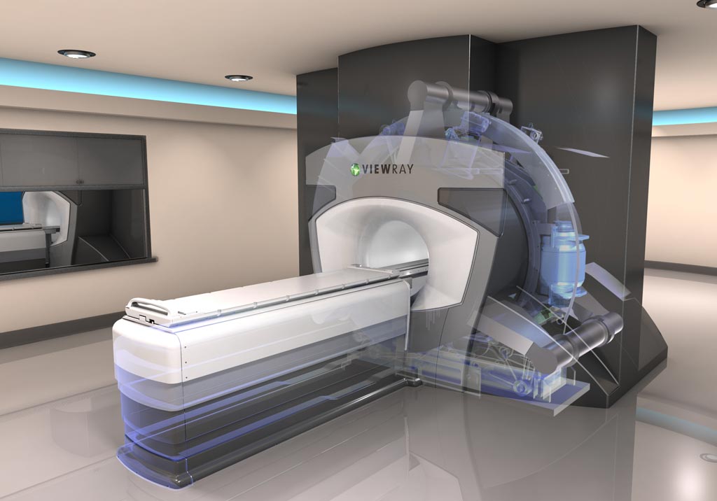 Imagen: El sistema de radioterapia MRIdian Linac (Fotografía cortesía de ViewRay).