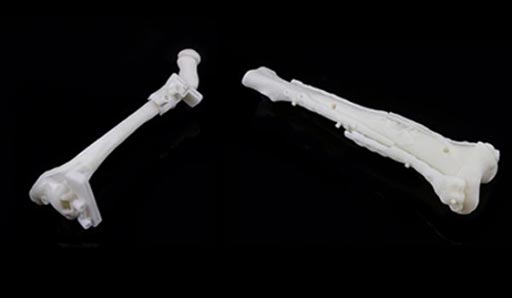 Imagen: Dos guías de osteotomía del radio y del cúbito, específicos para el paciente, impresas en 3D para la planificación de la cirugía en niños (Fotografía cortesía de Materialise).
