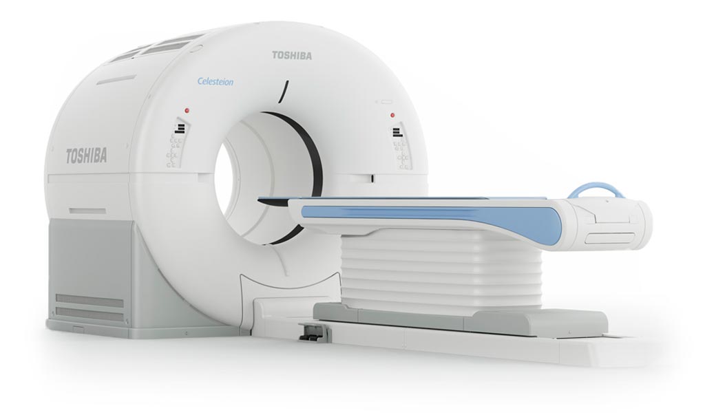 Imagen: El sistema Celesteion PUREViSION Edition PET/CT (Fotografía cortesía de Toshiba Medical Systems).