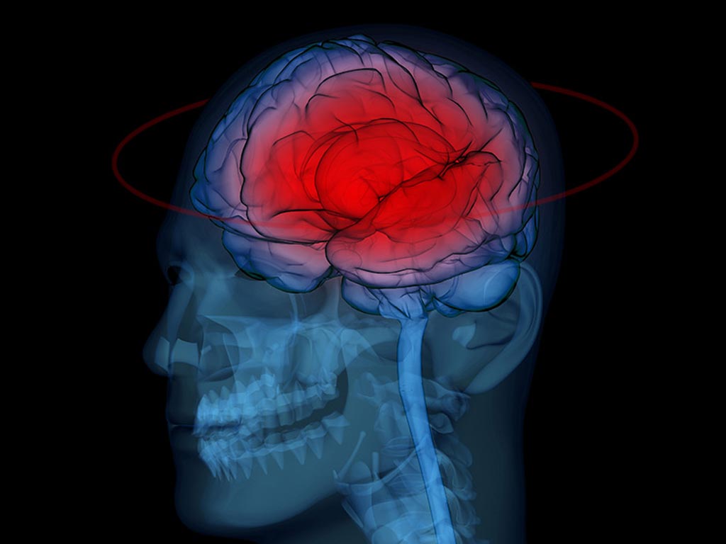 Imagen: Los resultados de un nuevo estudio muestran que la RM-DTI puede ayudar a los médicos a predecir el deterioro cognitivo y las lesiones cerebrales traumáticas leves (mTBI) en los combatientes profesionales (Fotografía cortesía de iStock). Imagen: Los resultados de un nuevo estudio muestran que la RM-DTI puede ayudar a los médicos a predecir el deterioro cognitivo y las lesiones cerebrales traumáticas leves (mTBI) en los combatientes profesionales (Fotografía cortesía de iStock).