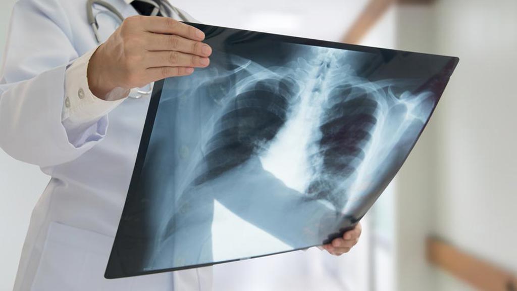 Imagen: Según un nuevo estudio, incluso las dosis bajas de radiación ionizante pueden aumentar el riesgo de enfermedades cardiovasculares (Fotografía cortesía de Getty Images). Imagen: Según un nuevo estudio, incluso las dosis bajas de radiación ionizante pueden aumentar el riesgo de enfermedades cardiovasculares (Fotografía cortesía de Getty Images).