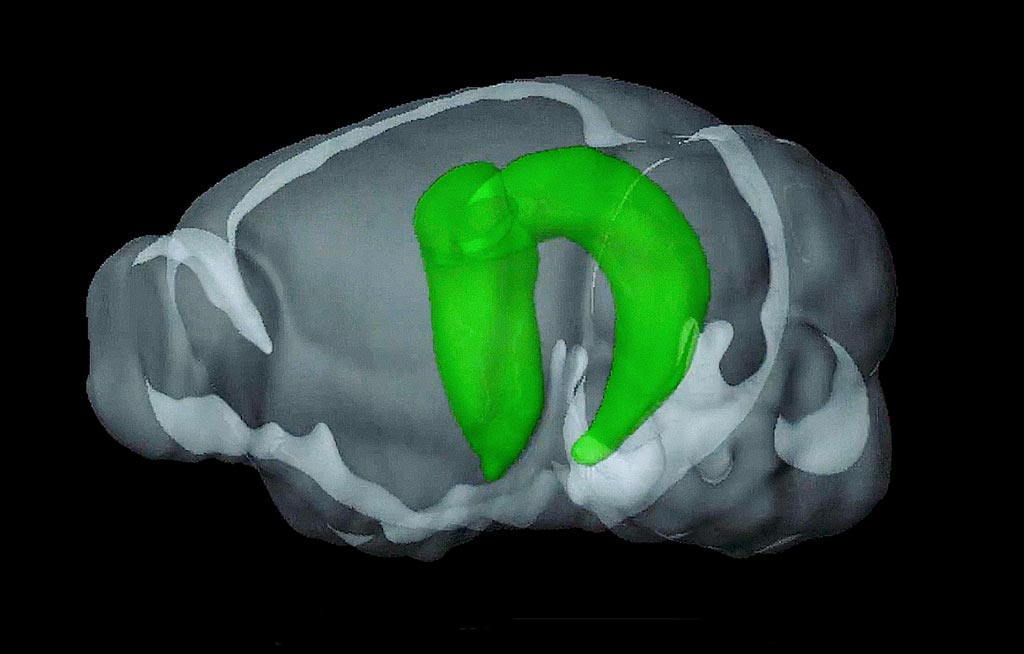 Imagen: los investigadores han revelado nuevos conocimientos sobre el papel del hipocampo en las redes cerebrales complejas (Fotografía cortesía de la Universidad de Hong Kong).