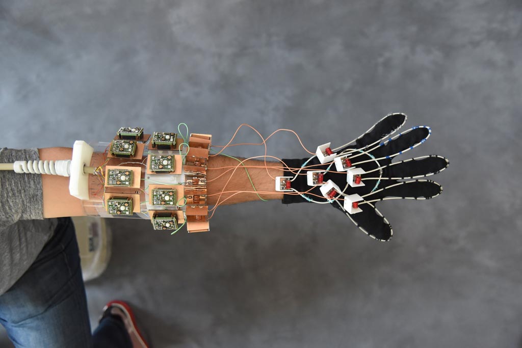 Imagen: El guante portátil para RM diseñado para visualizar articulaciones móviles y ayudar a diagnosticar las lesiones por esfuerzo repetitivo (Fotografía cortesía de NYU Langone).