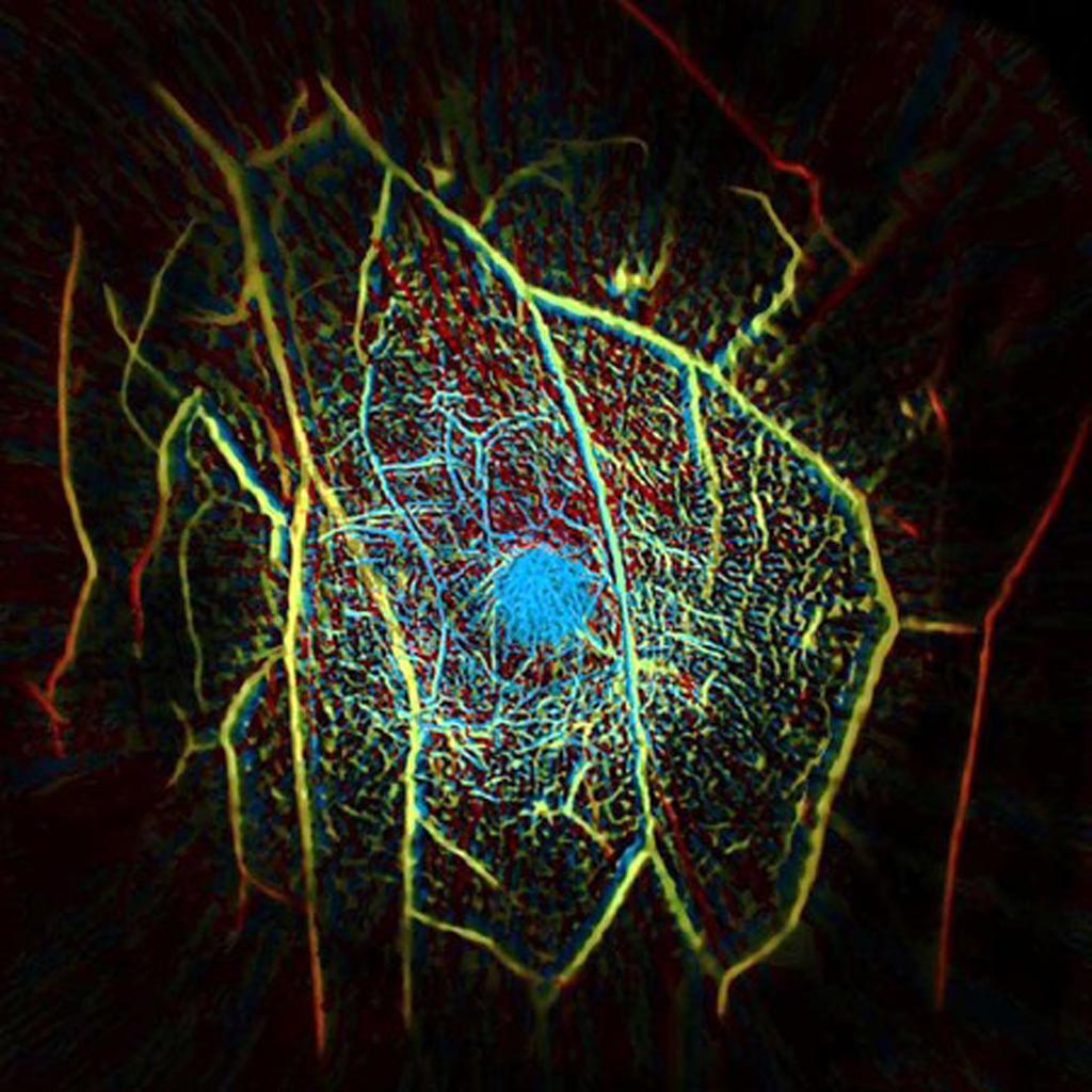 Imagen: Estructura vascular interna de mama creado con un escáner PACT (Fotografía cortesía de Caltech).