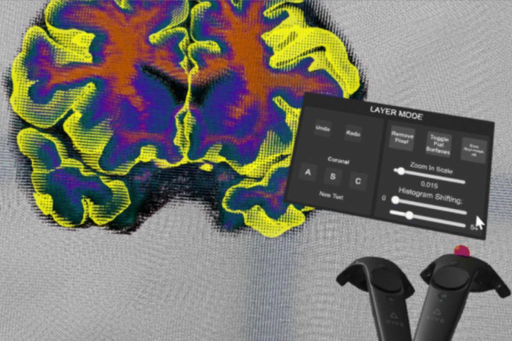 Imagen: El Segmentador Cerebral Virtual podría aumentar la eficiencia del análisis de los exámenes cerebrales (Fotografía cortesía de Dominique Duncan).