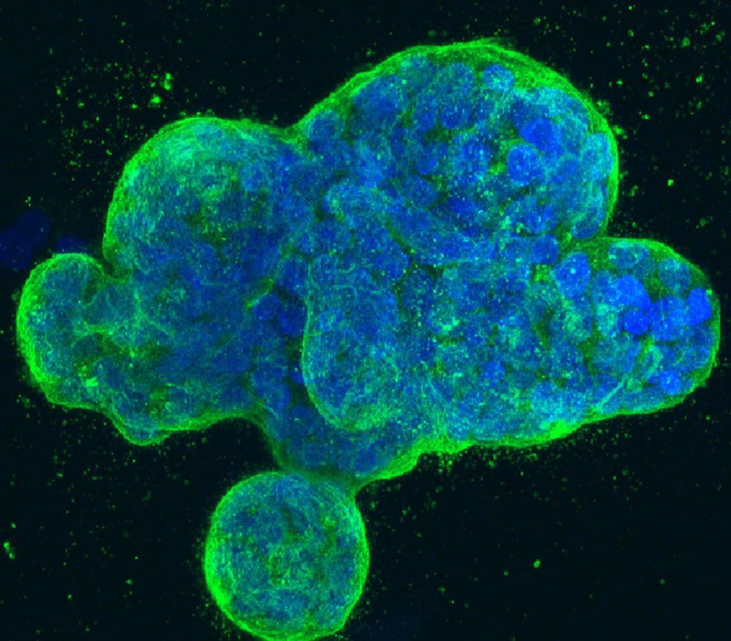 Imagen: Cultivo tridimensional de células de cáncer de mama humano, con el ADN coloreado de azul y una proteína en la membrana de la superficie celular de color verde (Fotografía cortesía de Tom Misteli, Ph.D., y de Karen Meaburn, Ph.D/NIH IRP) .