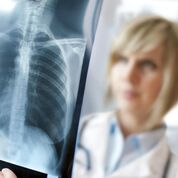 Imagen: Un estudio nuevo afirma que las radiografías de tórax pueden ayudar a limitar la terapia con antibióticos en caso de sospecha de neumonía (Fotografía cortesía de Alami).