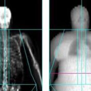 Imagen: Un estudio nuevo afirma que los pacientes obesos están expuestos a más radiación (Fotografía cortesía de la Universidad de Exeter).