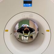 Imagen: La investigación muestra que las dosis de radiación de la TC varían ampliamente entre los países (Fotografía cortesía de Getty Images). Imagen: La investigación muestra que las dosis de radiación de la TC varían ampliamente entre los países (Fotografía cortesía de Getty Images).