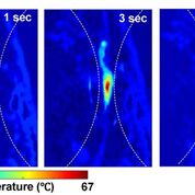 Imagen: Las imágenes fotoacústicas muestran temperaturas absolutas después de una ecografía enfocada de alta intensidad (Fotografía cortesía de la Universidad de Duke).