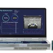 Imagen: El sistema de ultrasonido portátil, EchoSure, detecta los coágulos sanguíneos (Fotografía cortesía de Sonavex).