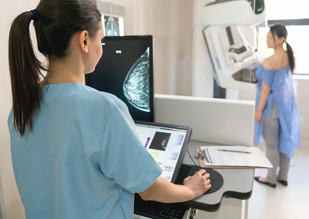 Imagen: Se espera que el crecimiento del mercado de mamografías en Norteamérica sea impulsado por el aumento de la prevalencia del cáncer de mama, una mejor infraestructura de atención médica y una mayor financiación para la investigación del cáncer de mama en la región (Fotografía cortesía de Shutterstock). Imagen: Se espera que el crecimiento del mercado de mamografías en Norteamérica sea impulsado por el aumento de la prevalencia del cáncer de mama, una mejor infraestructura de atención médica y una mayor financiación para la investigación del cáncer de mama en la región (Fotografía cortesía de Shutterstock).