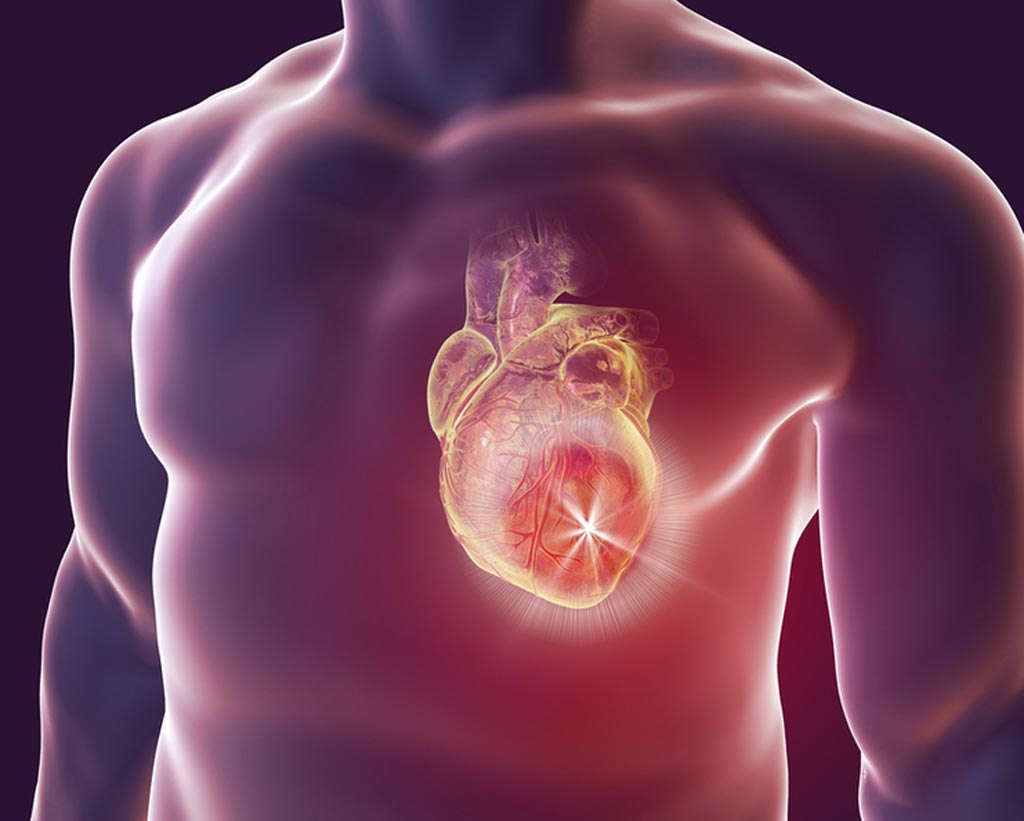 Imagen: Un algoritmo de aprendizaje automático entrenado para leer exámenes de imagenología fue más exacto para predecir los ataques cardíacos o la muerte que los médicos expertos (Fotografía cortesía de Shutterstock). Imagen: Un algoritmo de aprendizaje automático entrenado para leer exámenes de imagenología fue más exacto para predecir los ataques cardíacos o la muerte que los médicos expertos (Fotografía cortesía de Shutterstock).