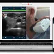 Imagen: La aplicación Clarius Live permite compartir los exámenes de ecografía (Fotografía cortesía de Clarius MobileHealth). Imagen: La aplicación Clarius Live permite compartir los exámenes de ecografía (Fotografía cortesía de Clarius MobileHealth).