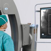 Imagen: Un sistema de reducción de la exposición a la radiación con IA (Fotografía cortesía de Omega Medical Imaging). Imagen: Un sistema de reducción de la exposición a la radiación con IA (Fotografía cortesía de Omega Medical Imaging).