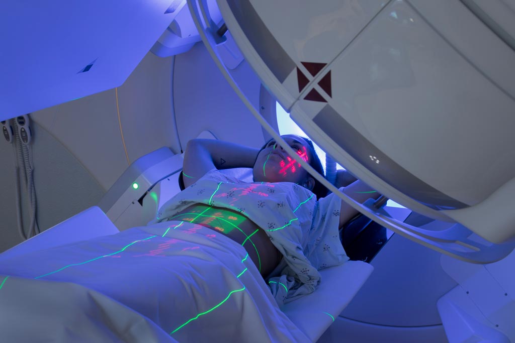 Imagen: Un estudio nuevo muestra que las dosis altas de RT aumentan la supervivencia de los pacientes de mesotelioma (Fotografía cortesía de iStock). Imagen: Un estudio nuevo muestra que las dosis altas de RT aumentan la supervivencia de los pacientes de mesotelioma (Fotografía cortesía de iStock).