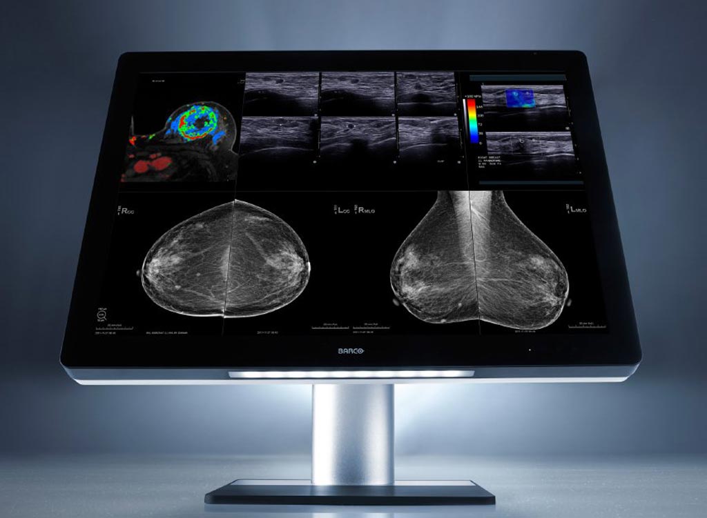 Imagen: Una solución avanzada de imagenología puede facilitar la lectura remota de radiologías (Fotografía cortesía de Barco).