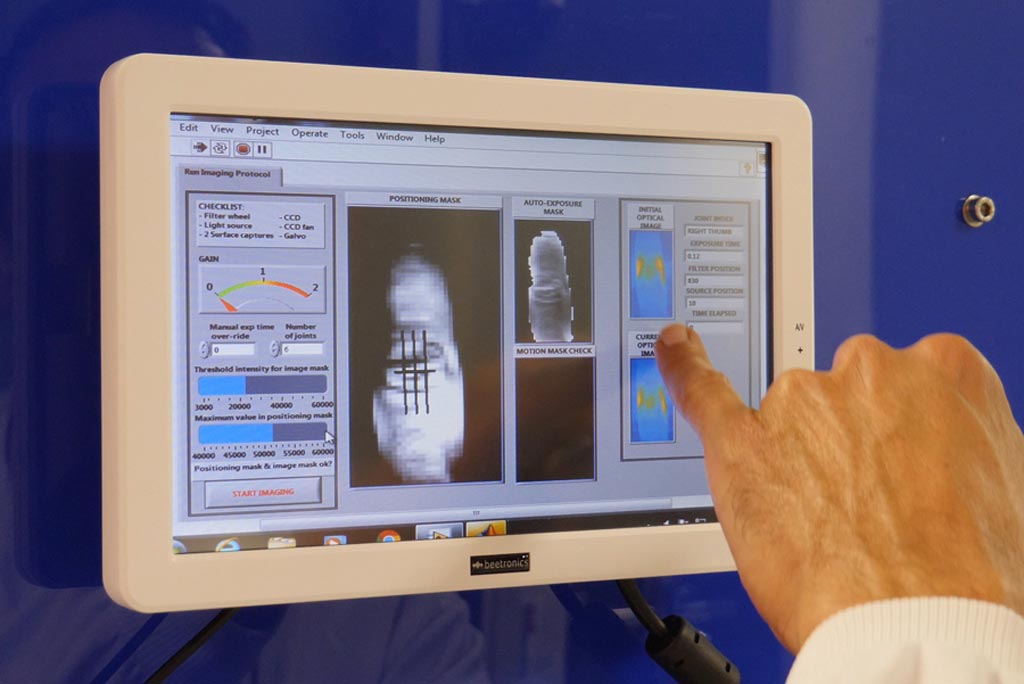 Imagen: La investigación muestra que la espectroscopia IR puede ayudar a identificar la artritis reumatoide (Fotografía cortesía de la UB).