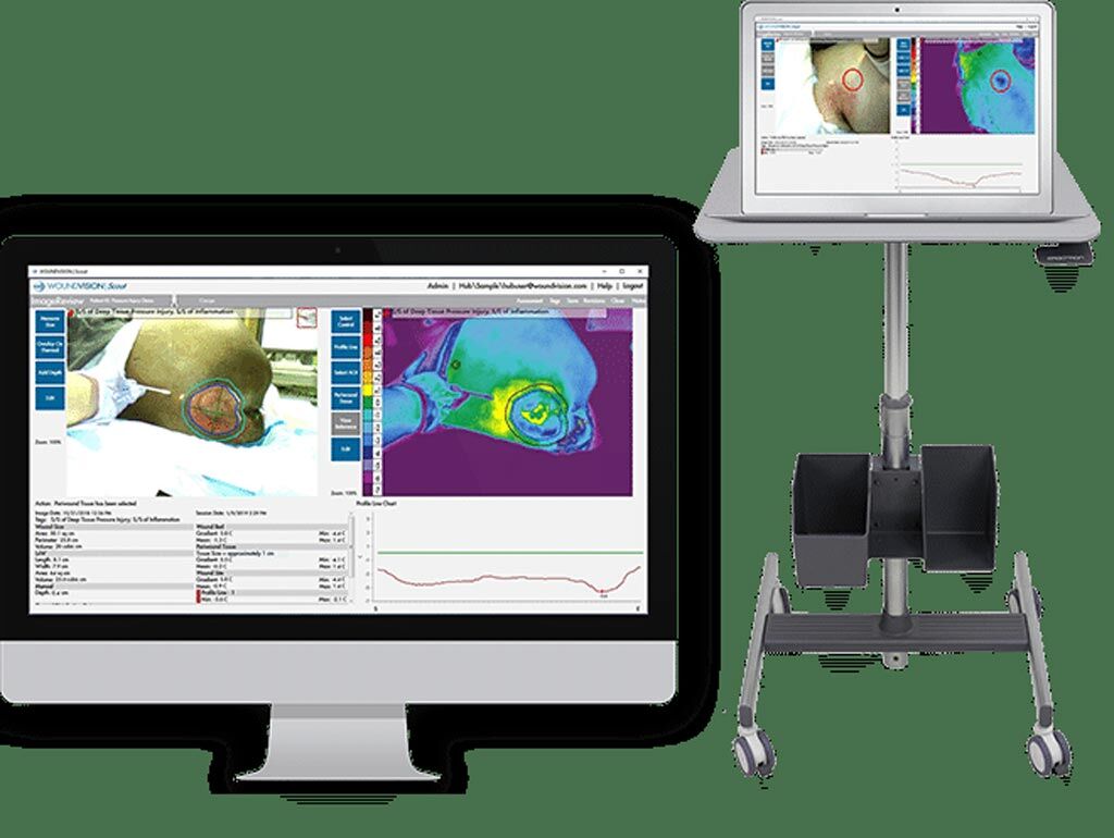 Imagen: El dispositivo de imagenología multimodal Scout, el software Scout y la aplicación móvil (Fotografía cortesía de WoundVision).