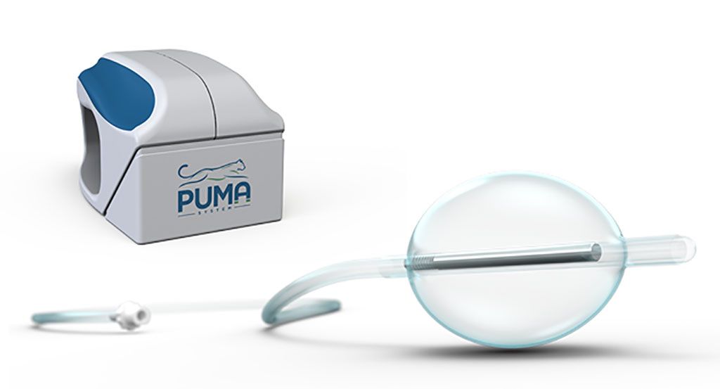 Imagen: Los imanes externos y de globo de PUMA-G (Fotografía cortesía de CoapTech)
