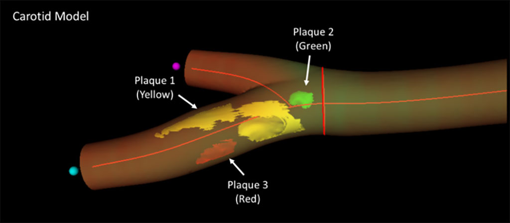 Imagen: Modelo 3D de una arteria femoral obtenido por imágenes 3D reales (Fotografía cortesía del CNIC)