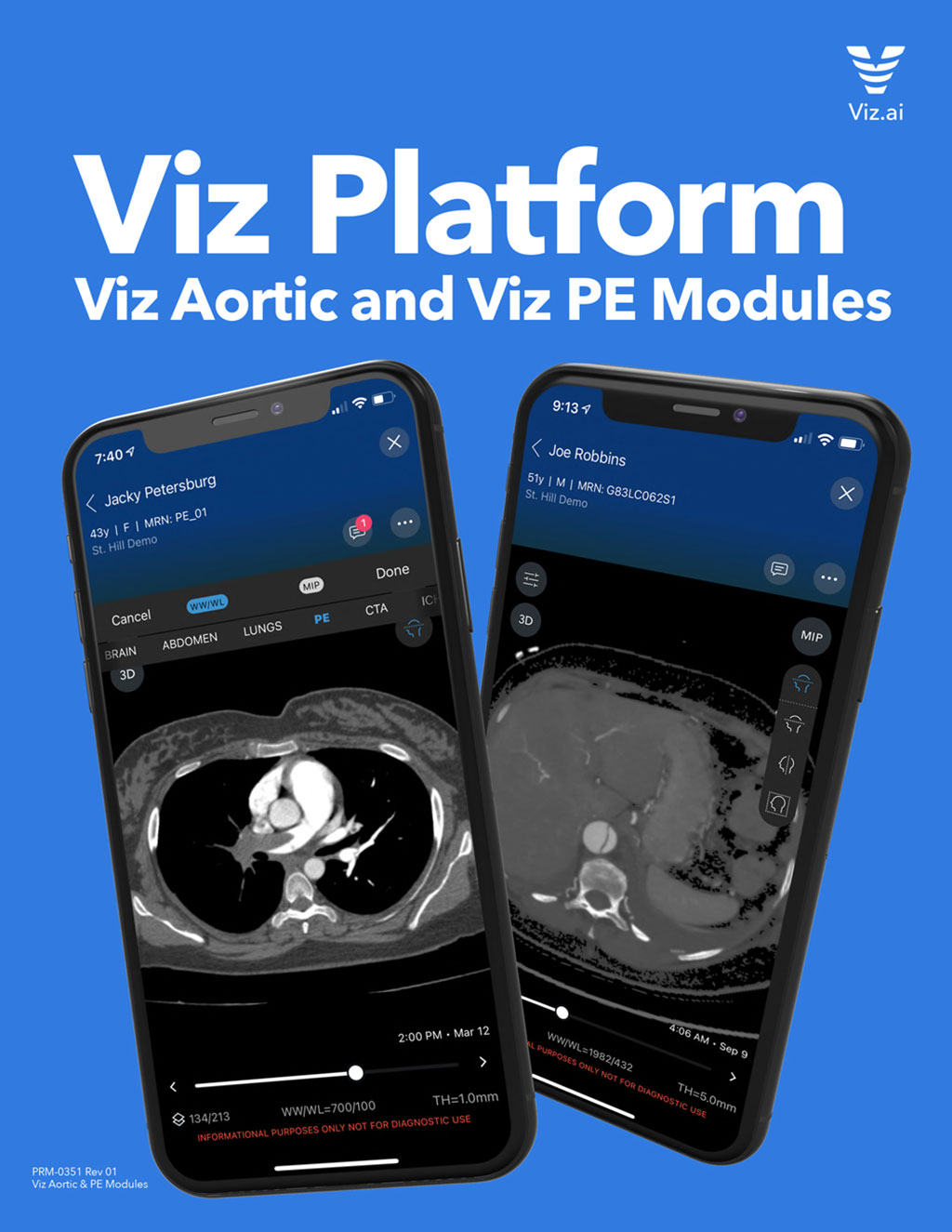 Imagen: Los módulos Viz aortic y Viz PE (Fotografía cortesía de Viz.ai, Inc.)