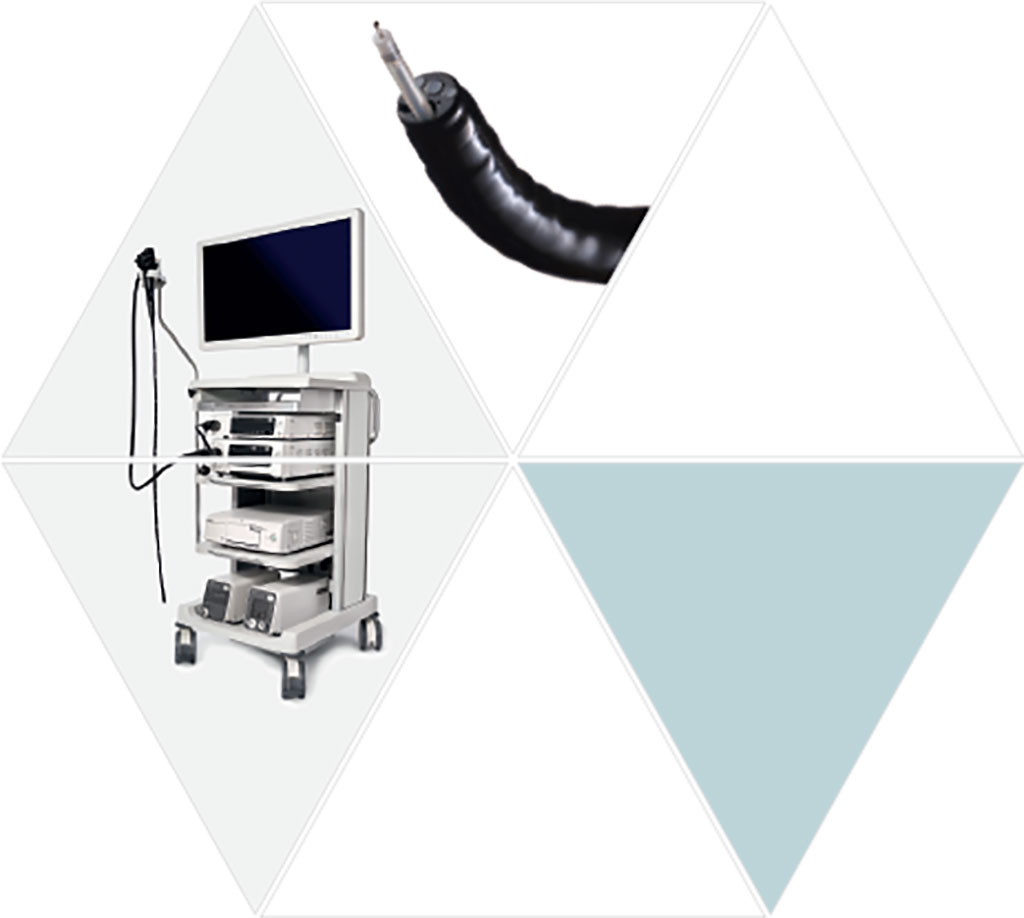 Imagen: El endoscopio de ultrasonido EG-740UT combinado con el ARIETTA 850 proporciona una excelente calidad de imagen de ultrasonido (Fotografía cortesía de Fujifilm)