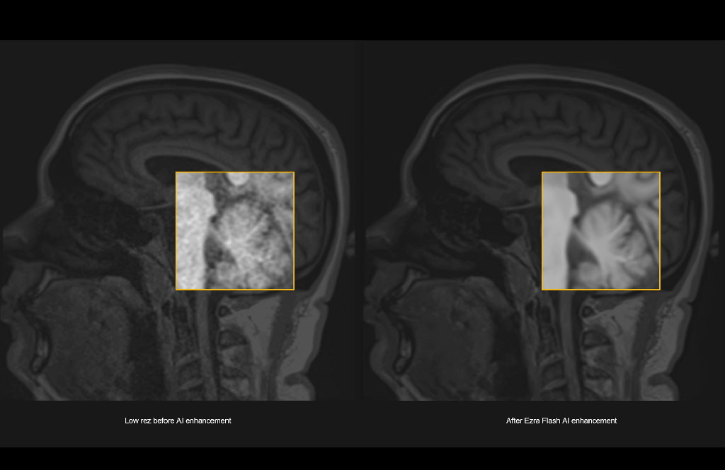 Imagen: La IA Ezra Flash ha recibido la autorización 510 (k) de la FDA, lo que permite el despliegue de la primera resonancia magnética del cuerpo completo de 30 minutos del mundo (Fotografía cortesía de Ezra)