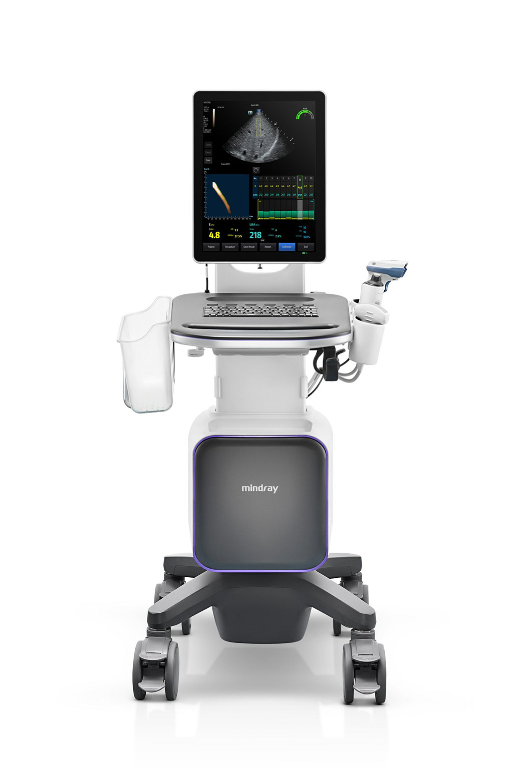 Imagen: El sistema de ultrasonido Hepatus 6 (Fotografía cortesía de Mindray)
