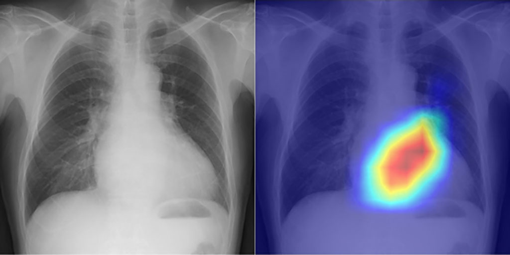 Imagen: Un modelo basado en inteligencia artificial clasifica las funciones cardíacas a partir de radiografías de torax (Fotografía cortesía de la Universidad Metropolitana de Osaka)