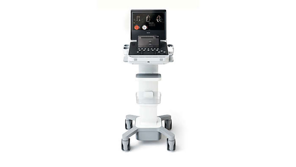 Imagen: El sistema de ultrasonido compacto de 5500CV ofrece funcionalidad completa y respuesta al primer escaneo (Fotografía cortesía de Royal Philips)