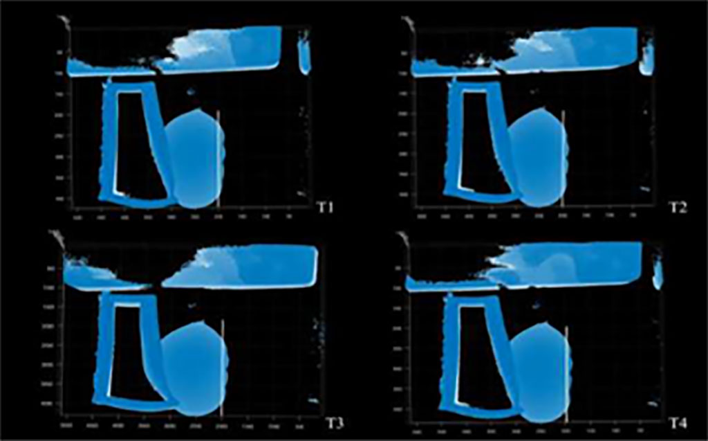 Imagen: El nuevo dispositivo mejora tanto la eficacia de las biopsias guiadas por resonancia magnética y la comodidad del paciente (Fotografía cortesía de la Universidad de Wisconsin-Madison)