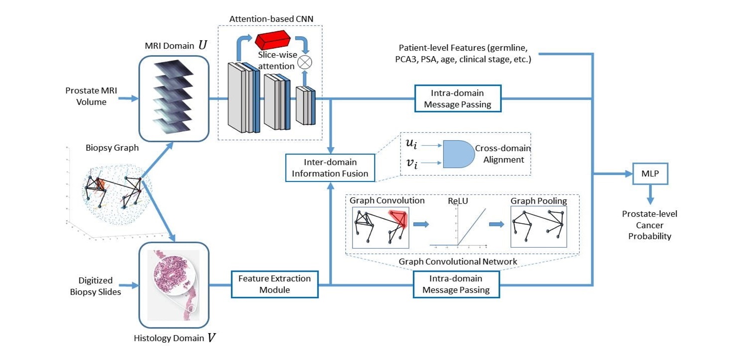 Imagen: Los investigadores están utilizando un enfoque de modelado multimodal para detectar cáncer de próstata agresivo (Fotografía cortesía de UCLA Health)