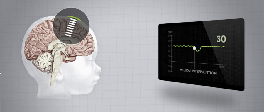 Imagen: NeoDoppler está diseñado para el monitoreo de ultrasonido de recien nacidos (Fotografía cortesía de NTNU)